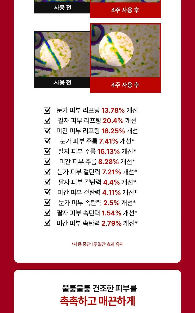[1등 총알샷 탄력 패치]니들리 5존 링클케어 3600샷 패치 상세페이지 22
